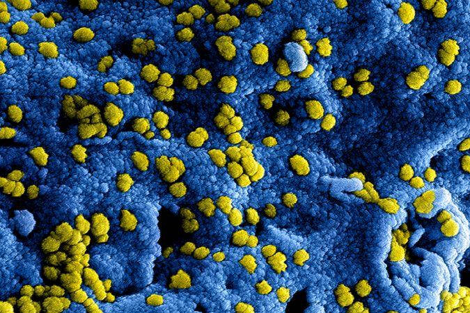 coronavirus onder de microscoop